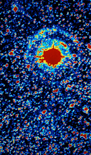 Light echoes from SN 1987A