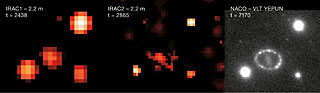 El anillo alrededor de SN1987A