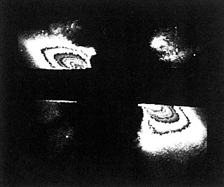 Possible planetary or protoplanetary disc around the star Beta Pictoris